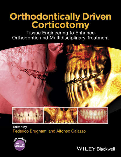 Orthodontically Driven Corticotomy — Группа авторов