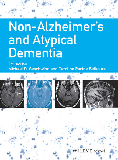 Non-Alzheimer's and Atypical Dementia — Группа авторов