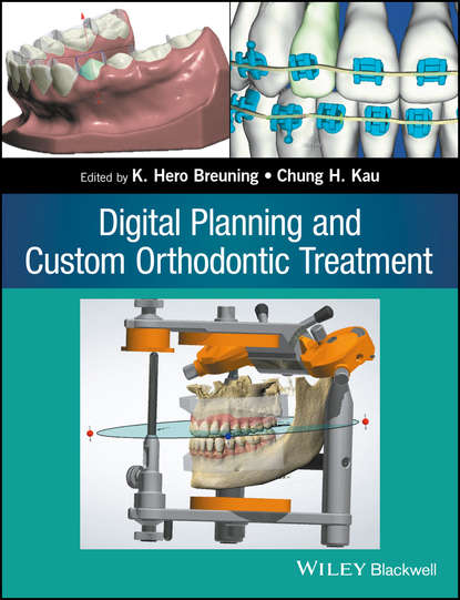 Digital Planning and Custom Orthodontic Treatment — Группа авторов