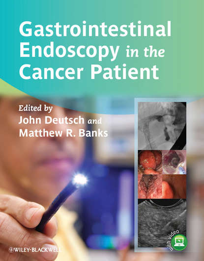 Gastrointestinal Endoscopy in the Cancer Patient — Группа авторов