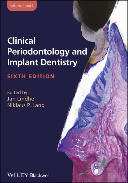 Clinical Periodontology and Implant Dentistry, 2 Volume Set — Группа авторов