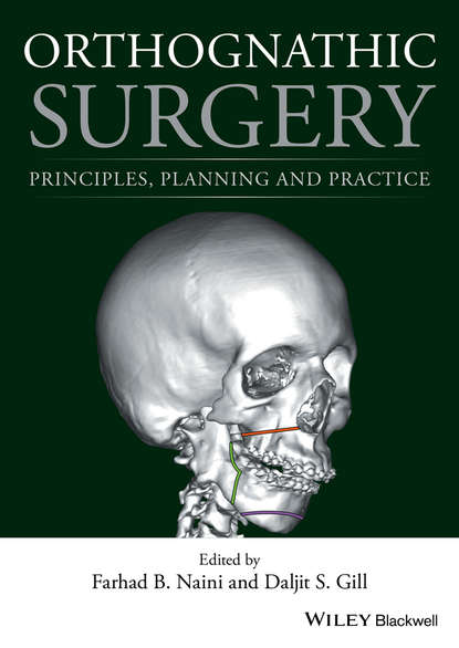 Orthognathic Surgery — Группа авторов