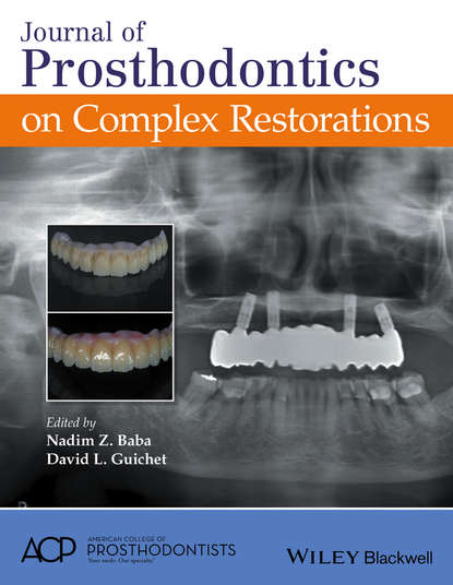Journal of Prosthodontics on Complex Restorations — Группа авторов