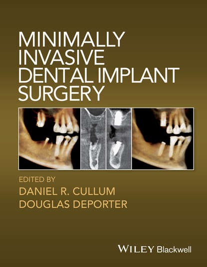 Minimally Invasive Dental Implant Surgery — Группа авторов