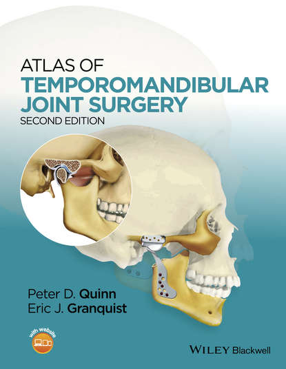 Atlas of Temporomandibular Joint Surgery — Группа авторов