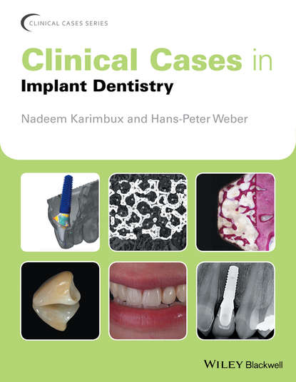 Clinical Cases in Implant Dentistry — Группа авторов