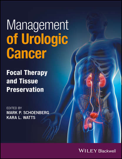 Management of Urologic Cancer - Группа авторов