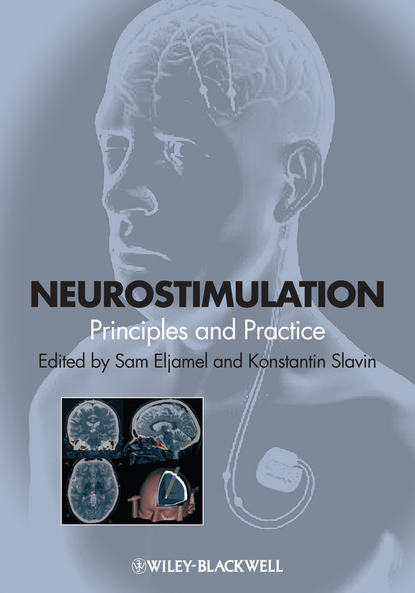 Neurostimulation — Группа авторов