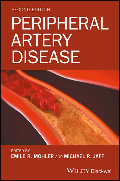 Peripheral Artery Disease — Группа авторов