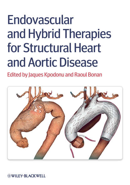 Endovascular and Hybrid Therapies for Structural Heart and Aortic Disease — Группа авторов