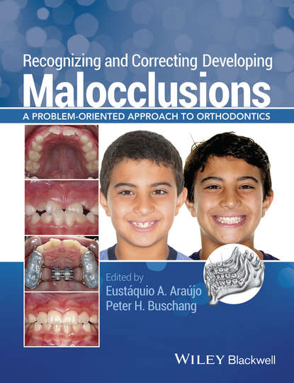 Recognizing and Correcting Developing Malocclusions — Группа авторов