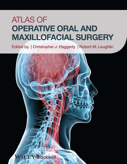 Atlas of Operative Oral and Maxillofacial Surgery — Группа авторов