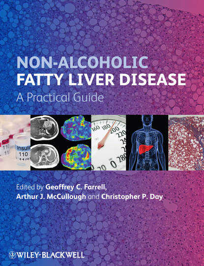 Non-Alcoholic Fatty Liver Disease — Группа авторов
