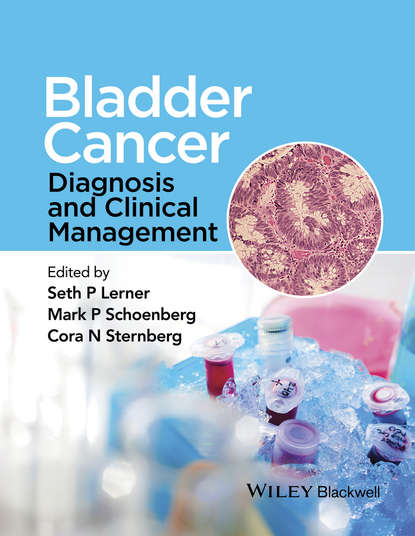 Bladder Cancer — Группа авторов