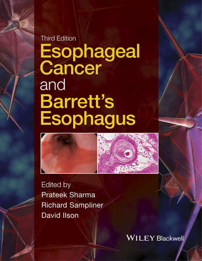 Esophageal Cancer and Barrett's Esophagus — Группа авторов
