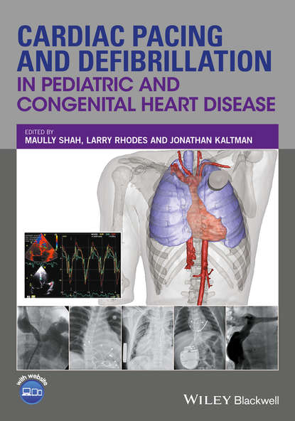 Cardiac Pacing and Defibrillation in Pediatric and Congenital Heart Disease — Группа авторов