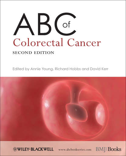 ABC of Colorectal Cancer — Группа авторов