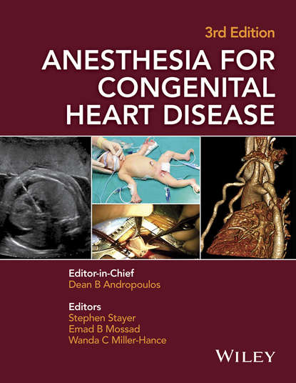 Anesthesia for Congenital Heart Disease — Группа авторов