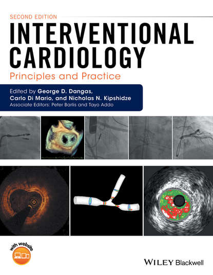 Interventional Cardiology — Группа авторов