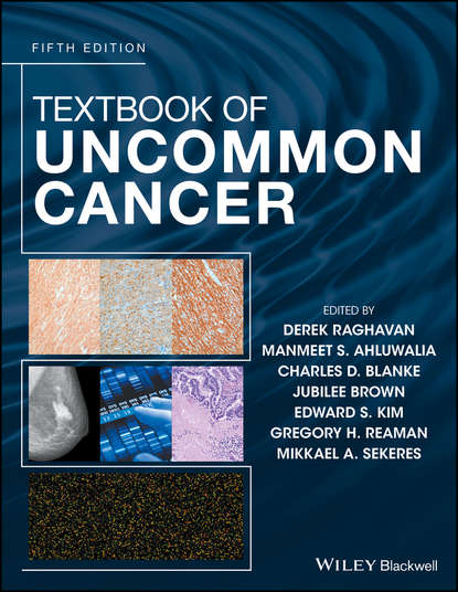 Textbook of Uncommon Cancer — Группа авторов