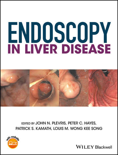 Endoscopy in Liver Disease — Группа авторов