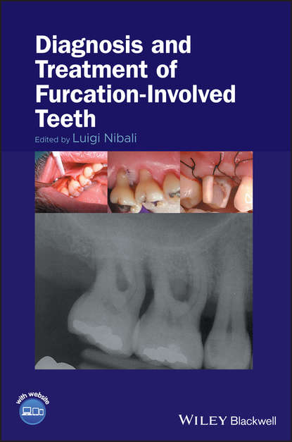 Diagnosis and Treatment of Furcation-Involved Teeth — Группа авторов