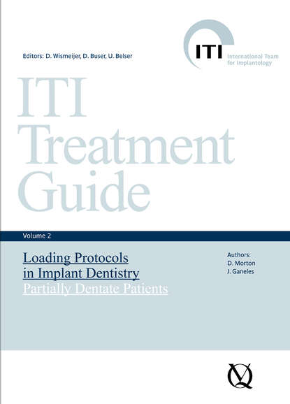 Loading Protocols in Implant Dentistry — Группа авторов
